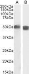 Forkhead Box O4 antibody, 45-623, ProSci, Western Blot image 