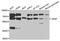 Arylsulfatase F antibody, STJ110401, St John