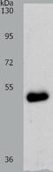 Zinc transporter ZIP6 antibody, TA323253, Origene, Western Blot image 