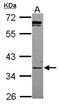 Phosphopantothenoylcysteine Synthetase antibody, GTX119988, GeneTex, Western Blot image 