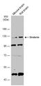 Drebrin 1 antibody, GTX111649, GeneTex, Western Blot image 