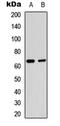 p65 antibody, LS-C358864, Lifespan Biosciences, Western Blot image 