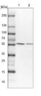 Tumor Necrosis Factor Receptor Associated Factor 3 antibody, NBP1-86644, Novus Biologicals, Western Blot image 