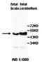 Septin-4 antibody, orb76954, Biorbyt, Western Blot image 