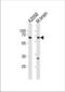 Leucine Zipper Tumor Suppressor 1 antibody, TA324508, Origene, Western Blot image 