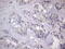 Tripartite Motif Containing 54 antibody, M11704, Boster Biological Technology, Immunohistochemistry paraffin image 