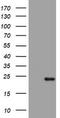 Visinin Like 1 antibody, TA802090AM, Origene, Western Blot image 
