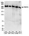 p220 antibody, A303-922A, Bethyl Labs, Western Blot image 