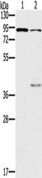 Cyclic Nucleotide Gated Channel Alpha 3 antibody, TA323330, Origene, Western Blot image 