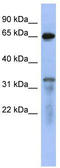 Rap1 GTPase-activating protein 1 antibody, TA342187, Origene, Western Blot image 