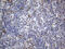 Drebrin 1 antibody, M05530-3, Boster Biological Technology, Immunohistochemistry paraffin image 