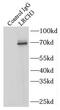 Leucine Rich Repeats And Calponin Homology Domain Containing 3 antibody, FNab04841, FineTest, Immunoprecipitation image 