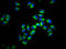 HLA class I histocompatibility antigen, alpha chain F antibody, LS-C680599, Lifespan Biosciences, Immunofluorescence image 