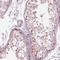 Spermatogenesis Associated 6 Like antibody, NBP1-84648, Novus Biologicals, Immunohistochemistry frozen image 