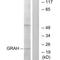 Granzyme H antibody, A08559, Boster Biological Technology, Western Blot image 