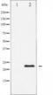 Caveolin 1 antibody, TA325301, Origene, Western Blot image 