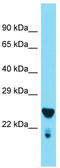 Mediator Complex Subunit 29 antibody, TA343222, Origene, Western Blot image 