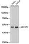 Lysophosphatidylcholine Acyltransferase 2 antibody, 19-475, ProSci, Western Blot image 