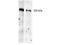 Thyroglobulin antibody, M00359, Boster Biological Technology, Western Blot image 