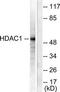 Histone Deacetylase 1 antibody, TA312925, Origene, Western Blot image 