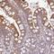 Zinc Finger Protein 266 antibody, HPA054110, Atlas Antibodies, Immunohistochemistry paraffin image 