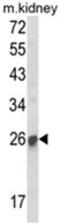 Suppressor Of Cytokine Signaling 1 antibody, AP18204PU-N, Origene, Western Blot image 