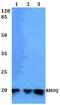 Ras-like protein TC10 antibody, A06900, Boster Biological Technology, Western Blot image 