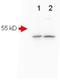 Amyloid Beta Precursor Protein antibody, AP09220PU-N, Origene, Western Blot image 