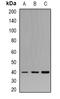 Pleckstrin antibody, orb341032, Biorbyt, Western Blot image 