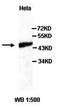 Proteasome 26S Subunit, ATPase 3 antibody, orb77446, Biorbyt, Western Blot image 