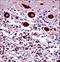Neuronal Calcium Sensor 1 antibody, LS-C166251, Lifespan Biosciences, Immunohistochemistry paraffin image 