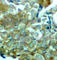 EGFR antibody, AP0218, ABclonal Technology, Immunohistochemistry paraffin image 