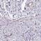 Protein DEPP antibody, PA5-58122, Invitrogen Antibodies, Immunohistochemistry paraffin image 