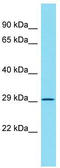 ATP Synthase Mitochondrial F1 Complex Assembly Factor 2 antibody, TA343195, Origene, Western Blot image 