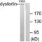 DYSF antibody, A01234-1, Boster Biological Technology, Western Blot image 