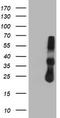 Metalloproteinase inhibitor 2 antibody, TA504044AM, Origene, Western Blot image 