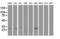 Deoxycytidine kinase antibody, LS-C172855, Lifespan Biosciences, Western Blot image 