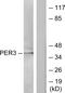 Period Circadian Regulator 3 antibody, GTX87243, GeneTex, Western Blot image 