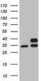 Succinate Dehydrogenase Complex Iron Sulfur Subunit B antibody, LS-C794253, Lifespan Biosciences, Western Blot image 