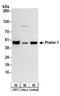 Proline Rich 5 antibody, A304-188A, Bethyl Labs, Western Blot image 