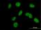 FA Complementation Group M antibody, H00057697-B01P, Novus Biologicals, Immunofluorescence image 