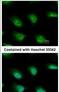 KH And NYN Domain Containing antibody, PA5-31660, Invitrogen Antibodies, Immunofluorescence image 