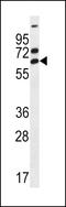 Zinc Finger Protein 835 antibody, LS-C160955, Lifespan Biosciences, Western Blot image 