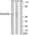 RAD23 Homolog B, Nucleotide Excision Repair Protein antibody, LS-C120494, Lifespan Biosciences, Western Blot image 