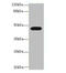 Lysosomal acid lipase/cholesteryl ester hydrolase antibody, orb240002, Biorbyt, Western Blot image 
