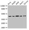 Eukaryotic translation initiation factor 3 subunit M antibody, LS-C677794, Lifespan Biosciences, Western Blot image 