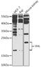 Von Hippel-Lindau disease tumor suppressor antibody, LS-C746916, Lifespan Biosciences, Western Blot image 