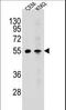MCH receptor 1 antibody, LS-C164088, Lifespan Biosciences, Western Blot image 