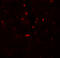 Solute Carrier Family 27 Member 6 antibody, 7297, ProSci Inc, Immunofluorescence image 