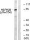 Heat shock protein HSP 90-beta antibody, TA312343, Origene, Western Blot image 